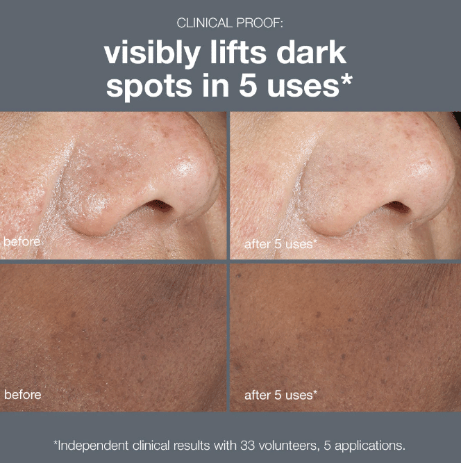 Dermalogica Powerbright Dark Spot Peel 50ml